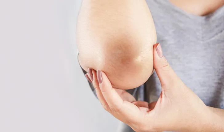 6 ways to fix blackened knees and elbows Guaranteed to make your skin whiter and brighter.